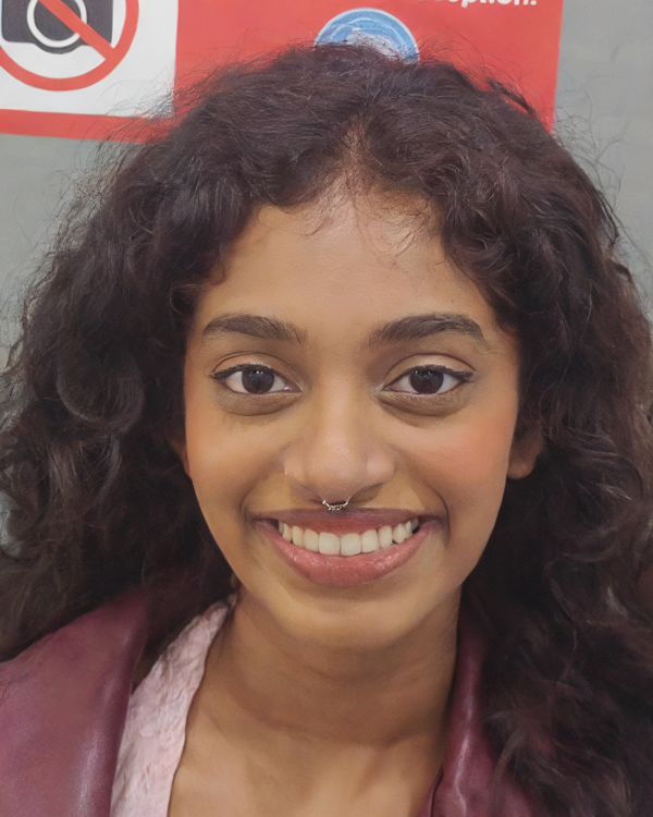 After image of brace alignment patient two Bangalore